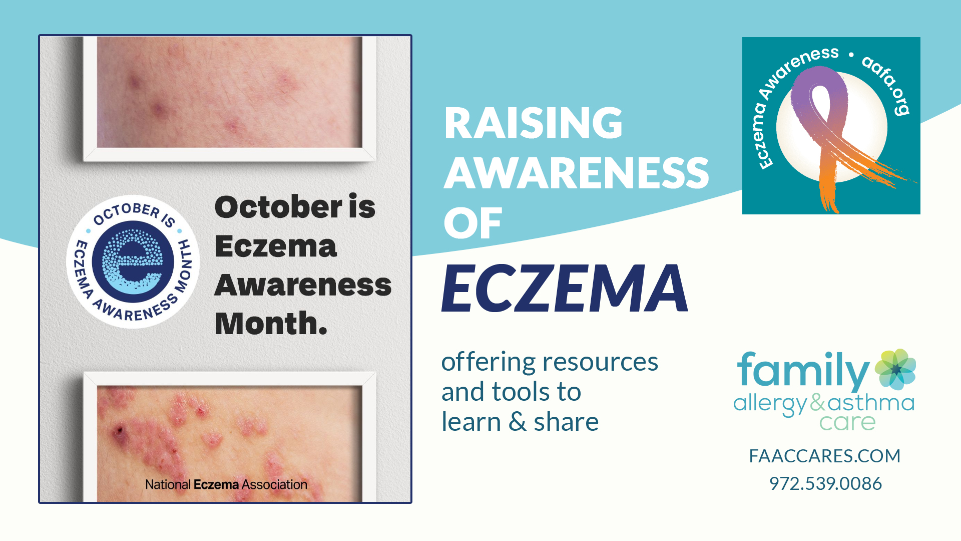 Denton Flower Mound Texas Eczema 2024 Awareness Allergist